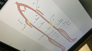 pad peripheral femoral and illiac artery diagram for cvis interventional reporting for fujifilm hims23