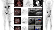 SNMMI Image of the Year2026