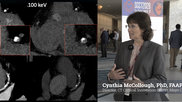 ynthia McCollough, PhD, FAAPM, FACR, FAIMBE, professor of medical physics and biomedical engineering, and director of the CT Clinical Innovation Center and X-ray imaging core at Mayo Clinic, Rochester, has been working on conventional CT and photon-counting CT research for years. She shares and overview of the advantages of photon-counting CT scanners as compared to conventional EID (energy-integrating detector) technology. 