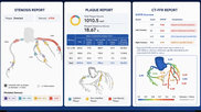 Keya medical's plaque analysis and FFR-CT reports generated from a single CT scan.
