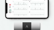 The AliveCor KardiaMobile 6-lead ECG remote monitoring system.
