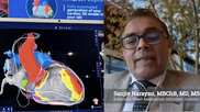 Sanjiv Narayan, MBChB, MD, MSc, FRCP, an American Heart Association volunteer, Director of the Electrophysiology Research and Atrial Fibrillation Program, and Co-Founder of the Stanford Arrhythmia Center, at Stanford Medicine, spoke in sessions at the European Society of Cardiology (ESC) 2026 Congress about the use of artificial intelligence in AFib care, using smarter detection to enable better outcomes.
