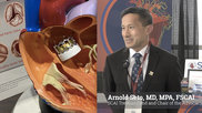 VIDEO: Arnold Seto, MD, MPA, FSCAI, Cath Lab Director, VA Long Beach Healthcare System, Long Beach, professor of medicine at Charles Drew University, and the Society for Cardiovascular Angiography and Interventions (SCAI) treasurer and and chair of the advocacy committee, explains SCAI's change in position on TAVR after listening to what members had to say in a survey.