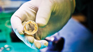 A Medtronic Evolut Corevalve TAVR valve in use at Emory.