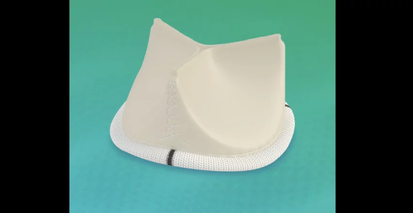 Abbott and the U.S. Food and Drug Administration (FDA) are warning healthcare providers about the potential risk of early structural valve deterioration (SVD) with Abbott’s line of Trifecta bioprosthetic heart valves. This includes the original Trifecta valve and the Trifecta GT, which are both designed to treat disease, damaged or malfunctioning aortic heart valves.