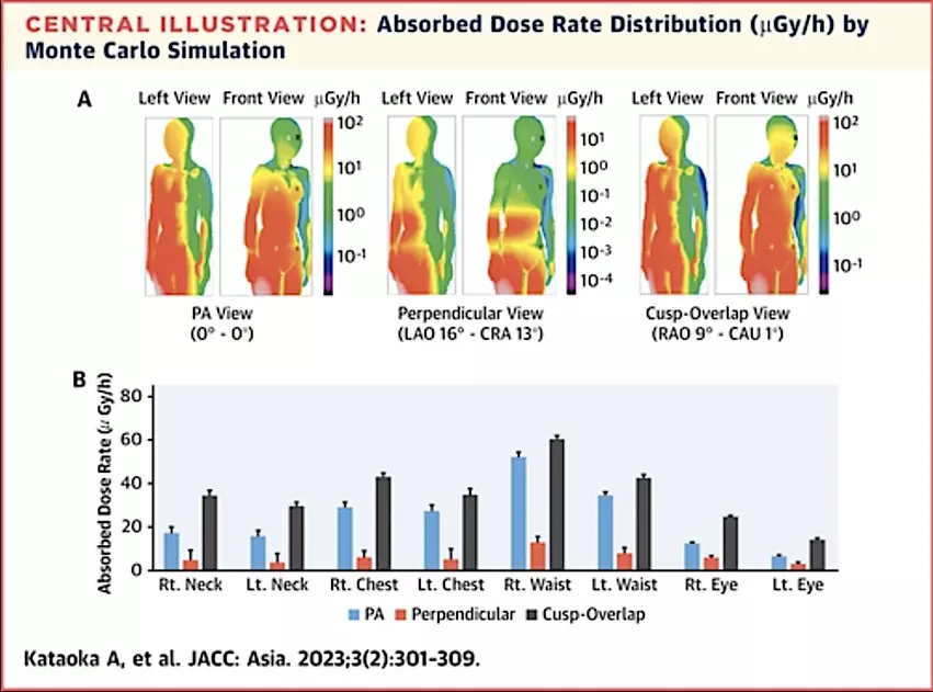 Absorbed X-ray radiation dose rate distribution in microgray per hour (μGy/h) assessed by Monte Carlo simulation for an interventional echocardiographer performing TEE imaging during cath lab structural heart procedures.