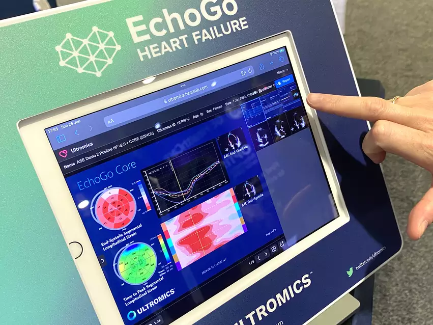 Ultromics EchoGo AI for cardiac ultrasound at ASE23.