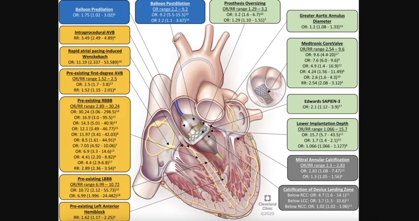 permanent pacemaker implantation after TAVR associated with high costs