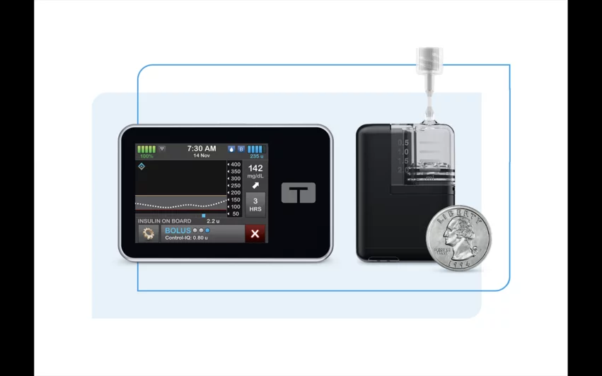 Tandem Diabetes Care is recalling a recent update of the mobile app for its t:slim X2 insulin pump due to repeated software issues that may cause the pump to shut down unexpectedly. The FDA has said this is a Class I recall. 