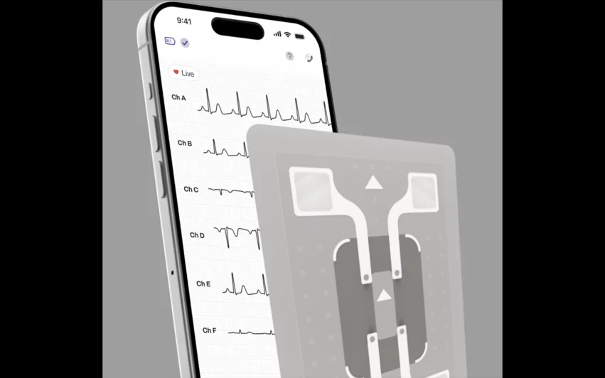 WearLinq's eWave six-lead wearable ECG monitor