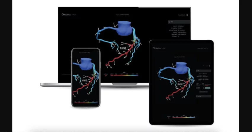 HeartFlow, a California-based healthcare technology company known for its non-invasive artificial intelligence (AI) technologies, has shared new seven-year data demonstrating the long-term impact of its AI-powered FFRCT Analysis and Plaque Analysis offerings.