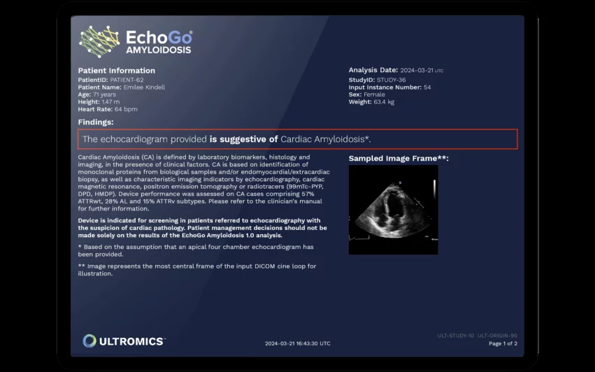 Ultromics EchoGo Amyloidosis artificial intelligence. A first of its kind AI model developed by Mayo Clinic and Ultromics Ltd., was found to be highly accurate in screening for cardiac amyloidosis in a large 2,612 patient clinical trial. The findings were published in the European Heart Journal.[1] Mayo Clinic, investigators at the University of Chicago Medicine and collaborators around the world at other sites, validated and tested the model on a large and multi-ethnic population.