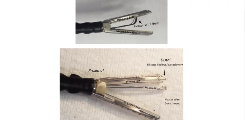 Maquet Cardiovascular, a subsidiary of Getinge, has issued an additional recall for its endoscopic vessel harvesting (EVH) devices over significant safety concerns, according to the U.S. Food and Drug Administration (FDA). 