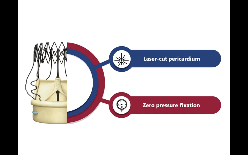 Corcym has received U.S. Food and Drug Administration (FDA) approval for a new version of its Perceval Plus surgical aortic heart valve that includes the company’s advanced LANCELOT features.