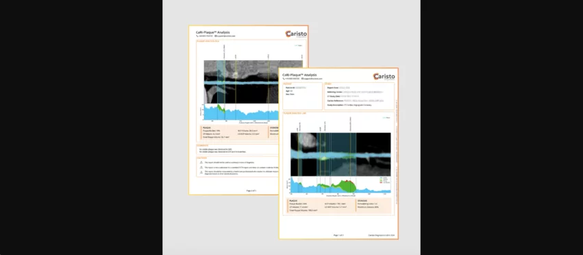 Caristo Diagnostics CaRi-Plaque AI