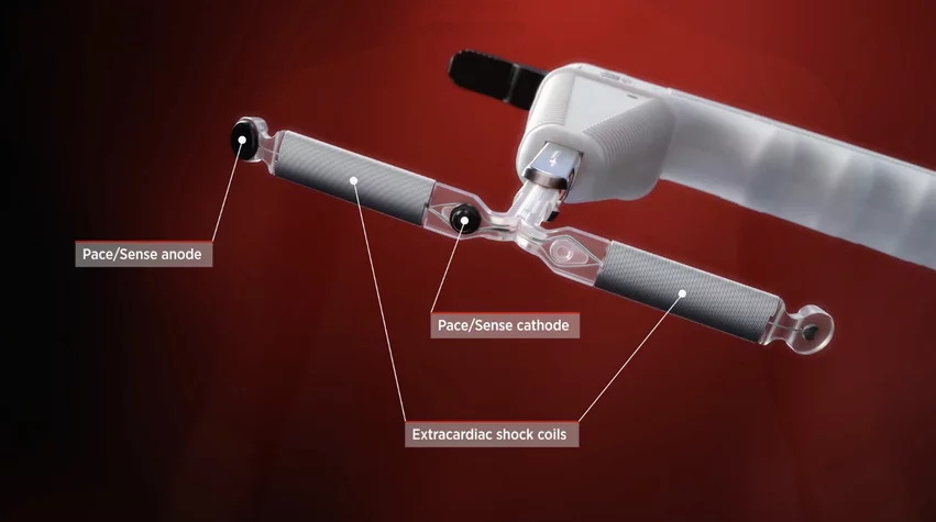 Abbott recently announced it is partnering with AtaCor Medical to develop a next-generation extravascular implantable cardioverter defibrillator (EV-ICD) system. AtaCor's investigational extravascular ICD lead will be paired with Abbott's investigational extravascular ICD system. 