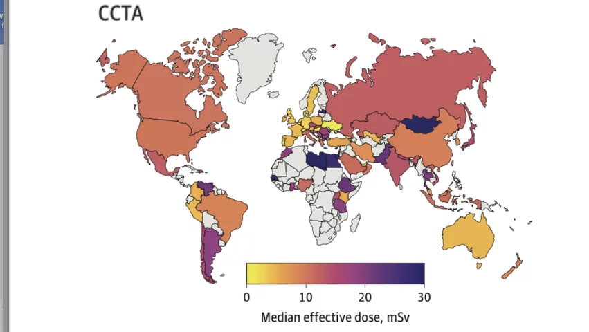 A new cross-sectional study of 742 centers in 101 countries involving the International Atomic Energy Agency (IAEA) offers the first world-wide glimpse into radiation dose variations used in coronary artery diagnostic imaging. It found wide various in dose, with highest doses in middle- and low-income countries, pointing to a critical need for better training, standardized protocols and new technology. The study was published in the Journal of the American Medical Association (JAMA).