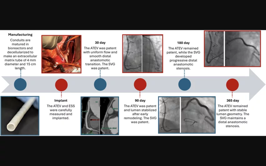  Timeline of the VCAB-1 First-in-Human Clinical Trial