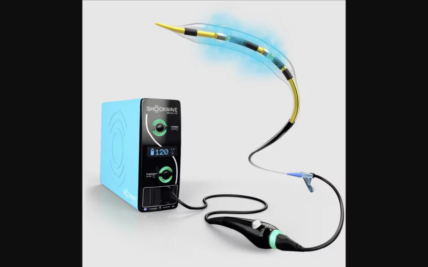 Shockwave C2 Aero Coronary IVL Catheter from Shockwave Medical