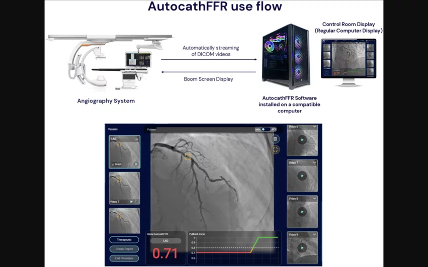 MedHub-AI AutocathFFR