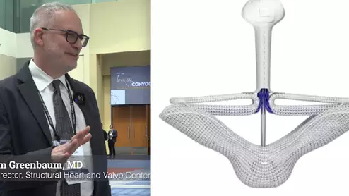 Adam Greenbaum, MD, Emory, explains the CLASP TR trial of the Pascal clip device for transcatheter repair, which was a late-breaking ACC22 study.