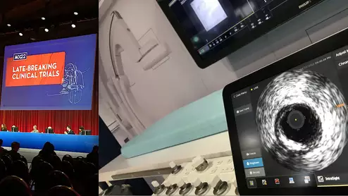 Several ACC 2022 late-breaking trials may have impacts on clinical practice for interventional cardiology and structural heart. One trial compared FFR vs. IVUS guided PCI for intermediate coronary lesions. Photos by Dave Fornell