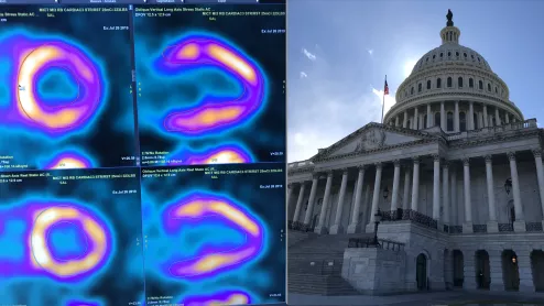 The American Society of Nuclear Cardiology (ASNC) is asking Congress to repeal the appropriate use software provision mandate, which physicians say is an obstacle to efficient care.