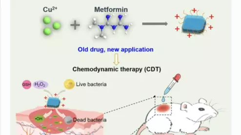 metformin chemodynamic therapy type 2 diabetes Nano Research