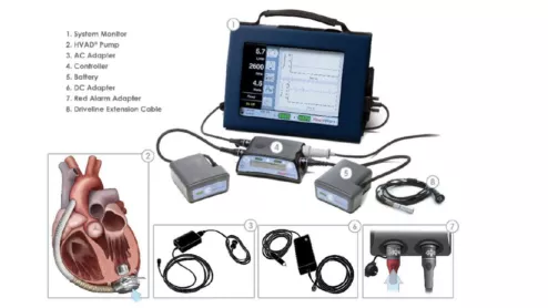 Medtronic is once again recalling its HeartWare Ventricular Assist Device (HVAD) pump implant kit, a part of the company’s HeartWare HVAD system. This is a Class I recall, which means using the device can lead to serious injury or death. The new recall includes more than 1,600 devices distributed from October 2006 to June 2021. 