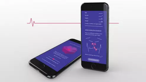 smartphone stethoscope Echoes