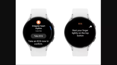 Samsung galaxy smartwatch showing atrial fibrillation (AFib) alerts