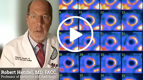 Robert Hendel, MD, Tulane University and former ASNC president, explains the pressing business aspects of nuclear cardiology and why ASNC included business management sessions at its 2023 annual meeting. #ASNC #ASNC23 #ASNC2023