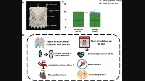 The Pioneer TAVR system from KOKA Lifesciences