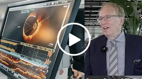 Gregg Stone, MD, discussing the value of IVUS and OCT over angiography along to guide PCI procedures and actually improve outcomes based on a 12,000 patient meta analysis presented at ESC 2023. #ESC #ESC23 #ESC2023