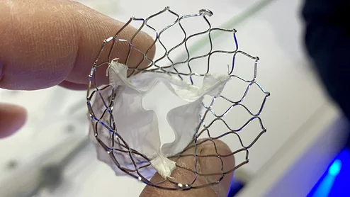 Medtronic CoreValve Evolut TAVR device in the Medtronic booth at TCT 2023. Photo by Dave Fornell
