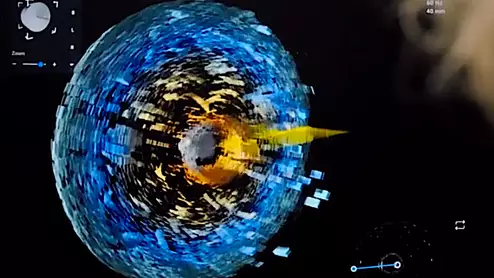 Luma Vison's Verafeye is the company’s 4D imaging and navigation platform for EP lab procedures for AFib.