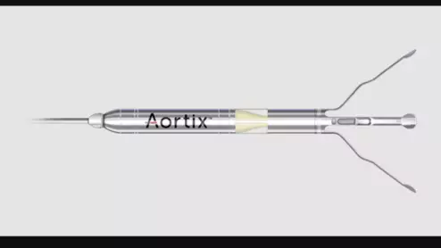 Procyrion's Aortix percutaneous mechanical circulatory support (pMCS) device targets acute decompensated heart failure (ADHF) patients with cardiorenal syndrome (CRS).