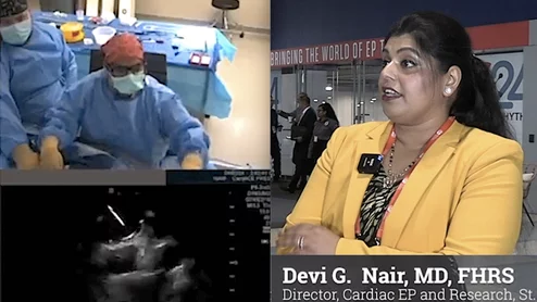 Video interview with Devi Nair, MD, who explains how to go fluoroless in PFA procedures. #HRS #HRS24 #HRS2024 #0Fluoro #zerofluoro #EPeeps
