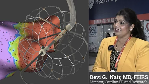 Video interview with Devi Nair, MD, who shares her experience of using the Sphere-9 PFA system in the FDA IDE late-breaking trial at HRS24. #HRS #PFA #HRS2024
