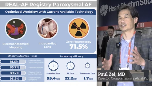 Paul Zei, MD, director of the comprehensive atrial fibrillation program at Brigham and Women’s Hospital, explained key findings from the late-breaking REAL-AF Registry at the Heart Rhythm Society (HRS) 2024 conference. This registry study evaluated the short- and long-term outcomes of radiofrequency ablation (RF) in treating both paroxysmal atrial fibrillation (PAF) and persistent atrial fibrillation (PsAF), revealing significant advancements in procedural techniques and patient safety. #EPeeps #HRS2024