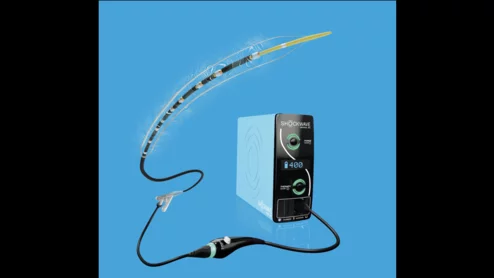 Shockwave Medical, a Johnson &amp; Johnson MedTech company, has officially launched its Shockwave E8 Peripheral IVL Catheter in the United States. Shockwave’s E8 catheter was designed specifically to treat patients with calcified femoropopliteal and below-the-knee (BTK) peripheral artery disease (PAD), including those diagnosed with complex chronic limb-threatening ischemia (CLTI).