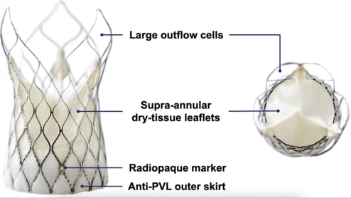 Venus-PowerX TAVR valve developed by Venus MedTech