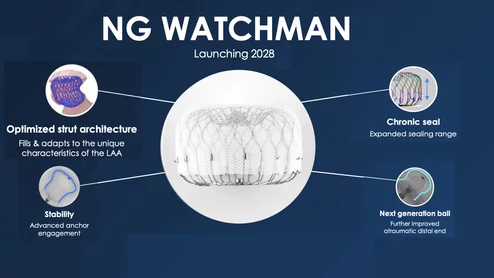 The next generation Watchman device is designed to better seal off complex LAA anatomy to prevent strokes in atrial fibrillation patients. It uses an optimized architecture to fill gaps and adapt to the unique characteristics of each patient's appendage, which come in a wide variety of shapes and sizes.