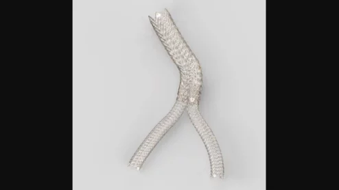 Gore Viabahn Fortegra Venous Stent 