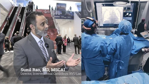 Sunil Rao, MD, director, interventional cardiology, cardiac catheterization laboratory, NYU Langone Heart, professor, Department of Medicine, the Leon H. Charney Division of Cardiology, NYU Grossman School of Medicine, discusses the heart team approach in the context to determining what is best for the patient in terms of bypass surgery or percutaneous coronary intervention.