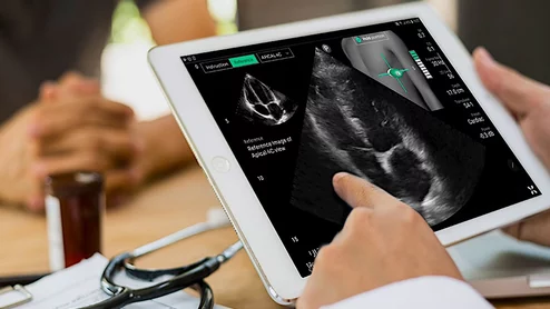 The U.S. Food and Drug Administration (FDA) has granted UltraSight an expansion of its Echo Stewardship Platform compatibility with additional ultrasound system types. This enables deployment of artificial intelligence (AI) guidance for focused cardiac ultrasound (FoCUS) across an entire healthcare system without the need to buy new ultrasound systems. The move enables health systems to expand use of the AI on compatible equipment they already own, including handheld, laptop and cart-based systems.