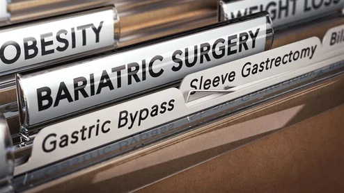 weight loss surgery bariatric Roux-en-Y gastric bypass and sleeve gastrectomy