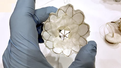 The Abbott Tendyne transcatheter mitral valve replacement system on. display at AATS 2026. Photo by Dave Fornell