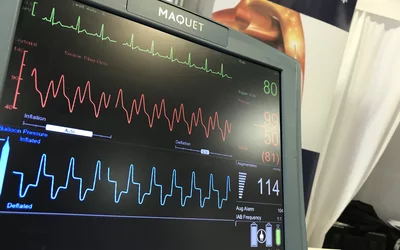 The waveform monitor of a Maquet CardioHelp intra-aortic balloon pump (IABP) on display on the expo floor at ACC 2022. #ACC22