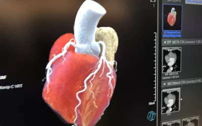 A 3D rendering of a patient's heart from a photon counting CT system in the Siemens booth. The vendor became the first to commercialize a photon-counting CT scanner in 2021, with the approval of the Naeotom Alpha. It can reduce radiation dose, produce clearer images and bins photos by energy to create spectral imaging capabilities on all scans. 